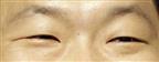 Psy